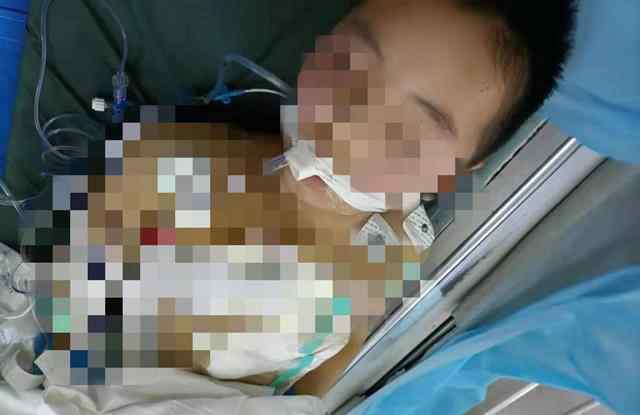 湖南沅江9岁凶手 湖南医生9岁儿子遭同村男子砍杀50多刀，至今未脱离生命危险
