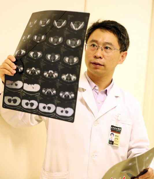 郑州男性来赞协和 协和医院医生吞枣核成热点 和患者换位思考网友点赞