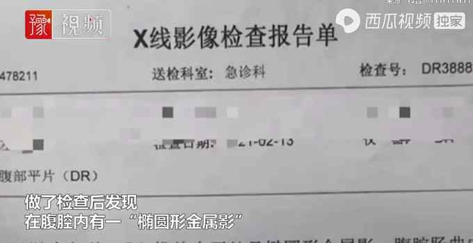 30多年头一次！吉林一男子吃饺子误将硬币吞进肚 网友隔空蹲结果