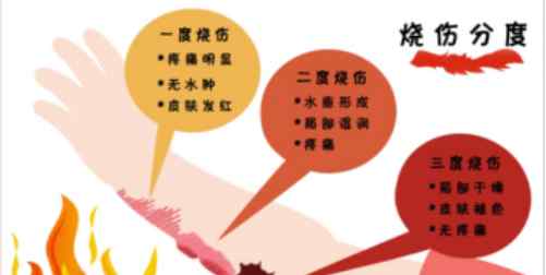 京万红烧伤膏的禁忌 活用京万红，应对烧烫伤三个等级各有妙招文章配图