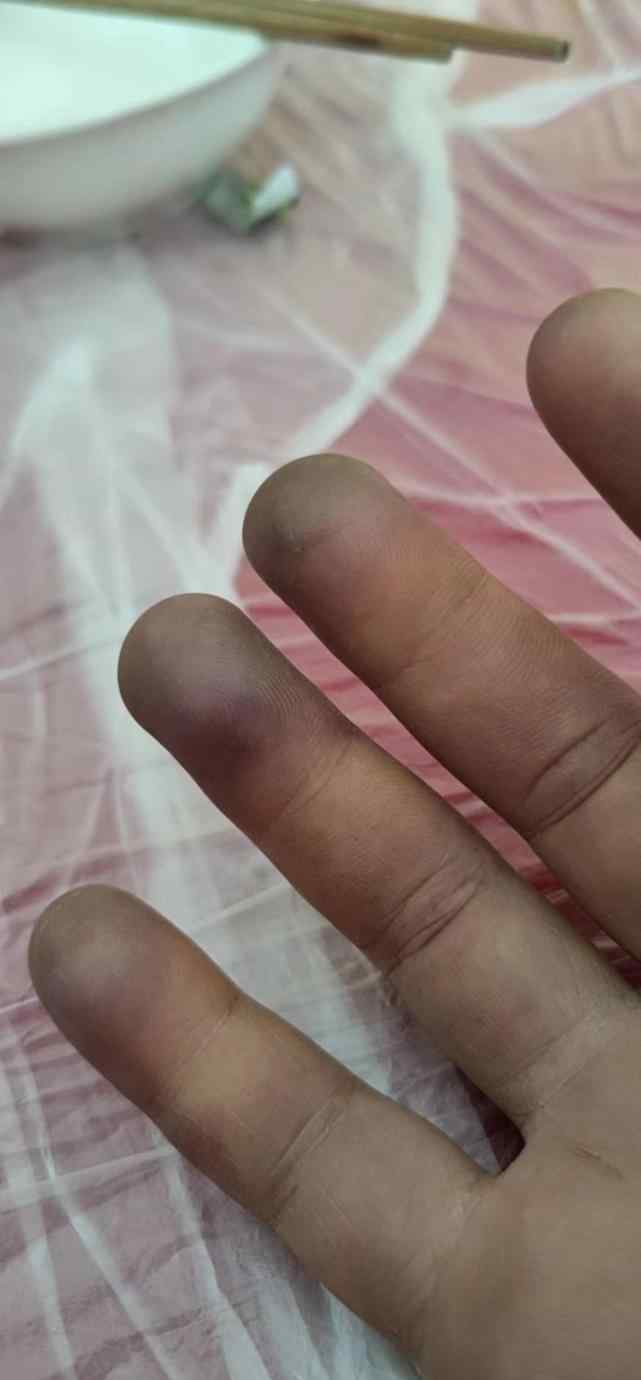 驴友偷登四姑娘山双腿摔骨折 向过路登山者求救：“不要撇下我不管”！