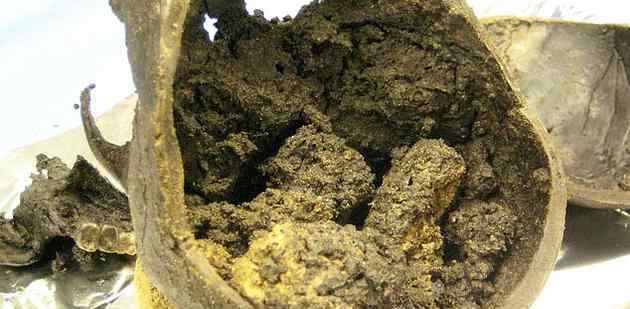 考古发现：赫斯灵顿大脑是世界上保存最完好的古人类大脑