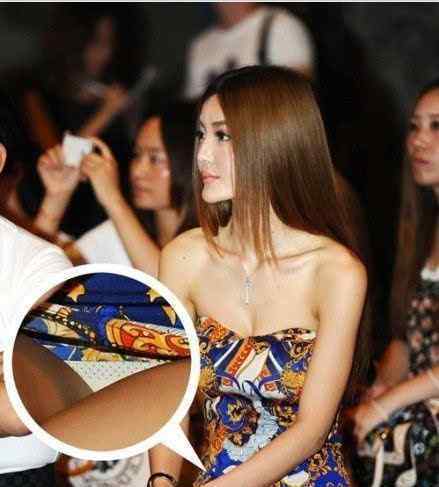整容失败女星有哪些女星整容失败丧命毁容悲惨案例