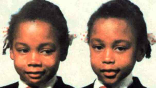 世界上最恐怖的双胞胎姐妹 妹妹詹妮弗·吉斯突然诡异死亡
