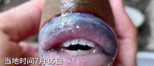 怪鱼长人类牙齿嘴唇 长着人类牙齿和嘴唇的炮弹鱼
