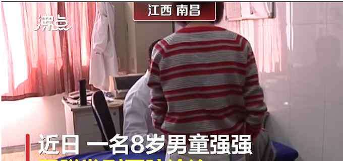 8岁儿童为什么掉头发 8岁男童脱发秃成地中海，就医时头发已掉三分之一！网友：挺“秃然”的