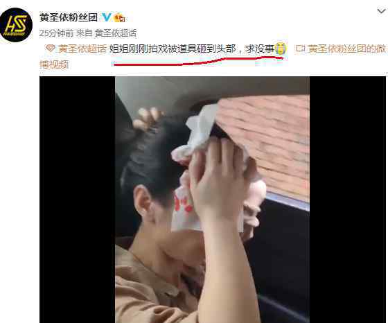 黄圣依拍戏时头部受伤 被道具砸到头血流了