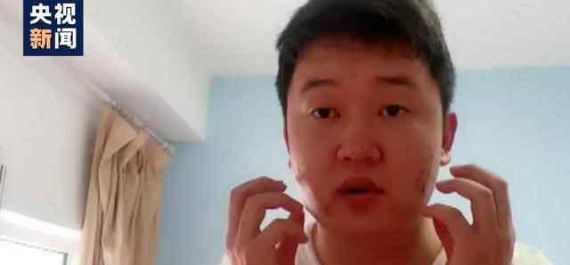 大连小伙再进隔离区热出花癣斑 蒋文强主动请缨当志愿者