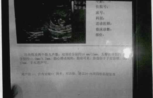 女友说在国外生下双胞胎儿子 已婚男看到宝宝照片却懵了