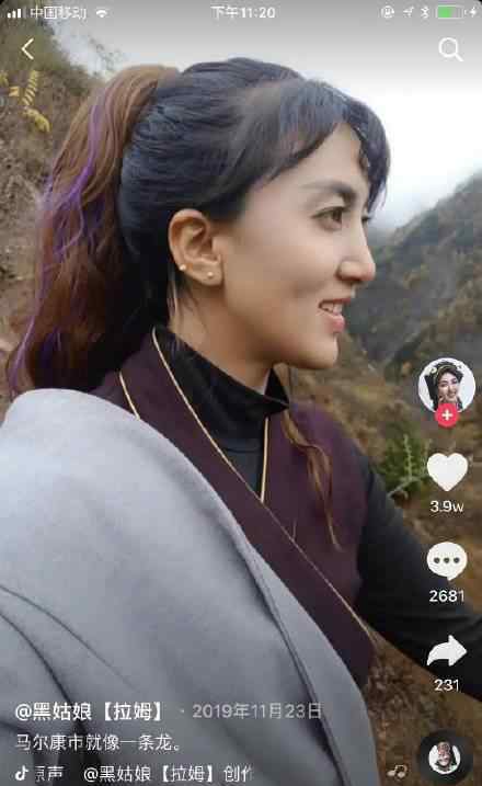 网红拉姆遭前夫纵火重度烧伤