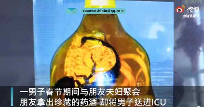 男子春节聚会被药酒送进ICU 医生一看才知此药酒是外用的！
