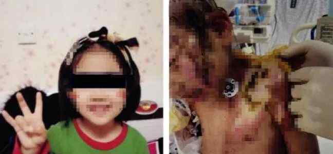 爱心如潮涌向被虐女童 父亲:不再接受捐赠