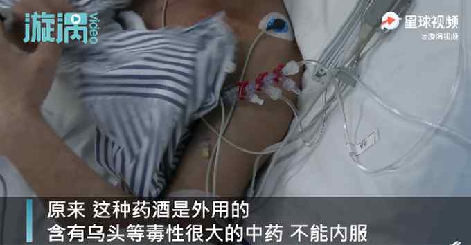 男子春节聚会被药酒送进ICU 医生一看才知此药酒是外用的！