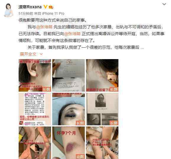 短跑名将张培萌发文回应家暴 晒“睾丸外伤”证据