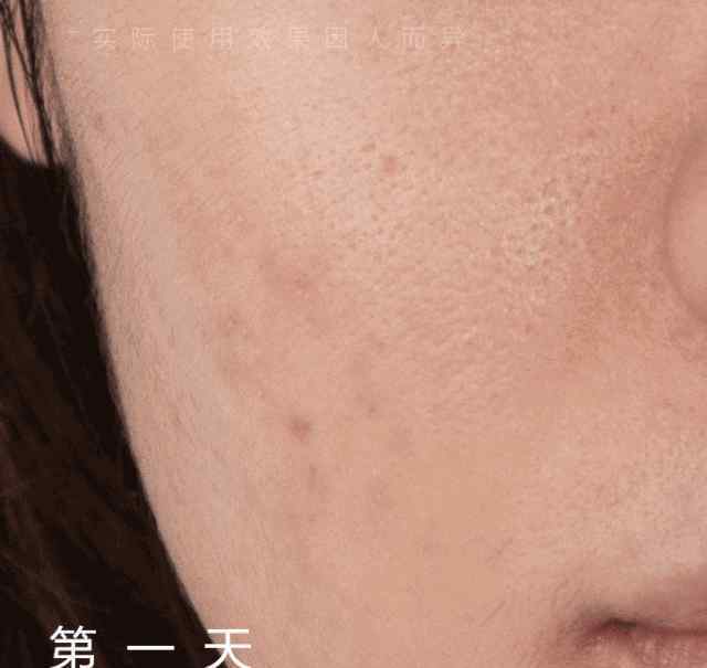 橹管会影响脸部皮肤吗 几十块就能收毛孔！这支超好用的“磨皮原液”，连我的黑头也治好了