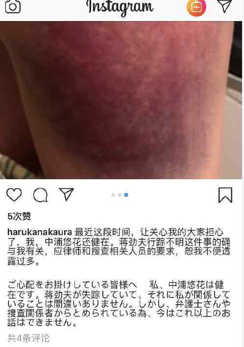 蒋劲夫女友晒身上多处淤青照：对方失踪与我有关