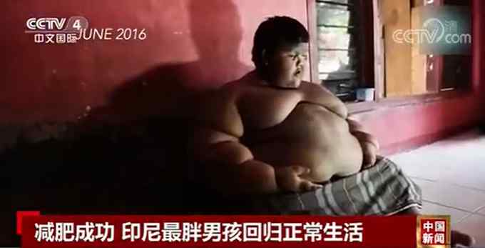 世界最胖男孩减重200斤 前后变化有多大？网友：太不容易了！