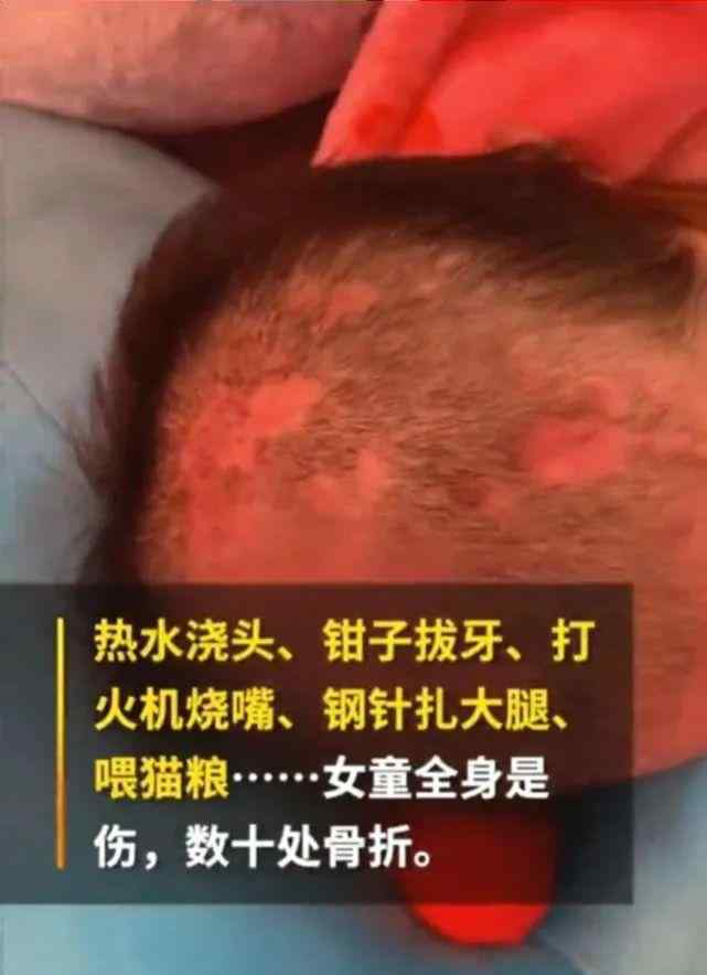 虐点伢 6岁女孩被亲妈虐待，手段残忍气炸全网：离婚后，她为何沦为人渣？！