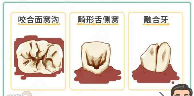 2岁宝宝牙腐蚀怎么补救 2岁半宝宝乳牙全烂光，就是这件事没做好