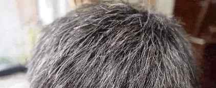 醋洗头发的功效与作用 听说白醋和生姜片洗头可以让白发变黑发？事实是......