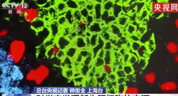 中国科学家发现成体肝脏中新生肝细胞来源 网友：肝病患者福音！