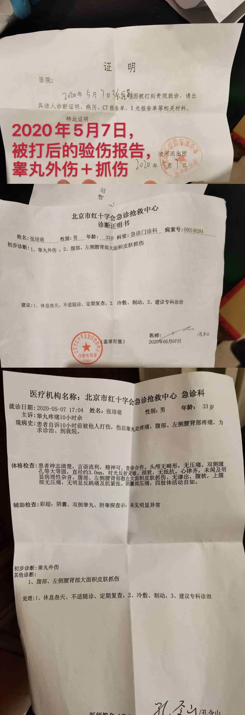 漠寒 张培萌时隔40天后发声，称自己才是受害者，漠寒是个暴力的泼妇