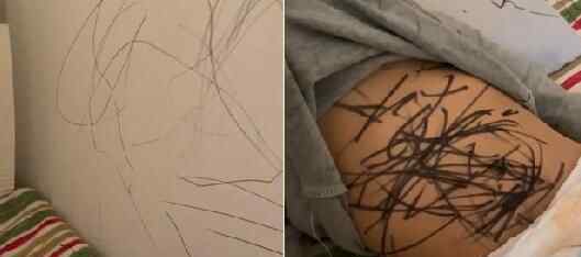 女子睡醒发现2岁孩子十分安静 掀开他衣服一看瞬间崩溃