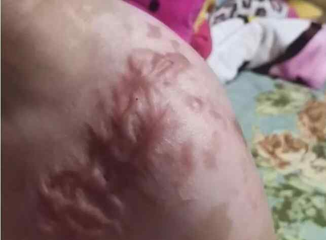 抚顺6岁被虐女童父亲望严惩前妻 为什么要这样说