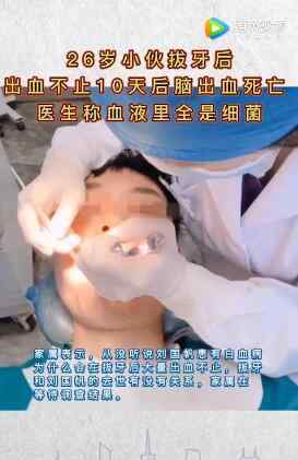 小伙拔牙10天后脑出血死亡 生前和牙医聊天记录被查