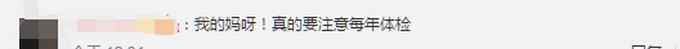 超9成大肠癌源于息肉癌变 网友：痔疮算吗？