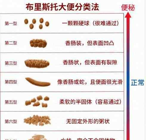 大便一直不成形是肠癌 大便不成形一定是“肠癌”吗？勿慌，医师告诉你该怎么办！