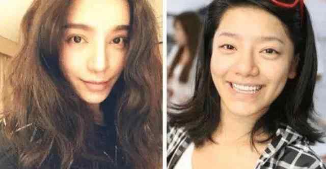 超女整容 她曾是超女冠军，实力堪比李宇春和张靓颖，如今整容撞脸多位明星