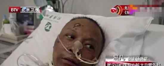 武汉中心医院易凡医生出院 目前情况怎样