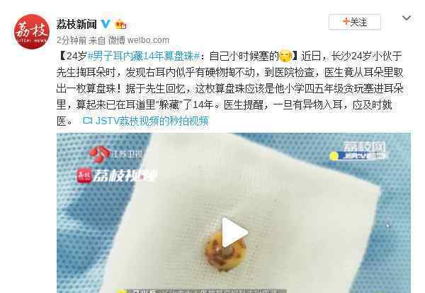 耳内藏14年算盘珠 小伙心真大详情经过居然是这样的