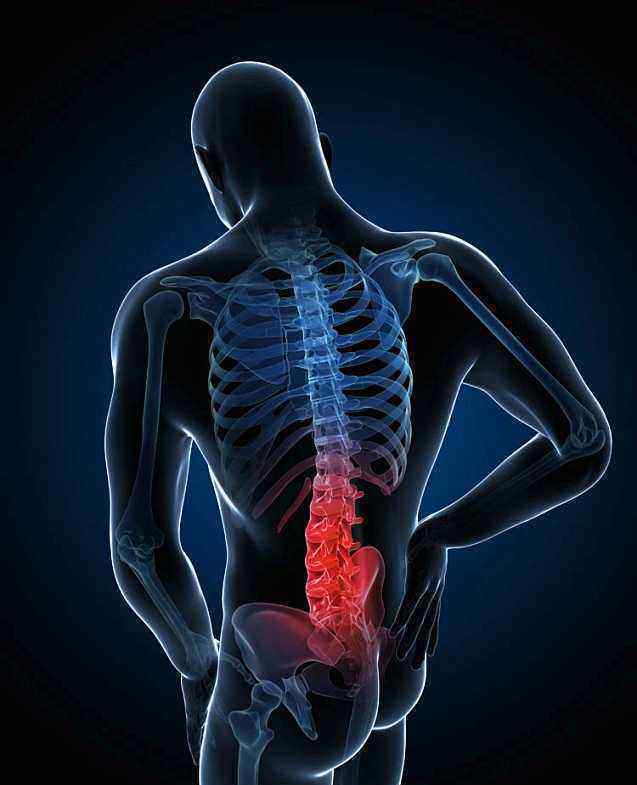 非S矫姿舒腰椅，对腰肌劳损说“NO”文章配图