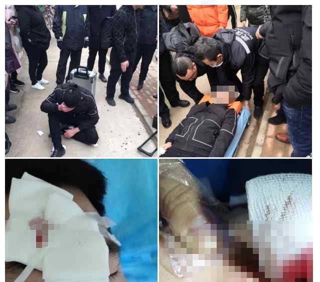 验房师验房遭殴打:头部严重受伤，缝了6针