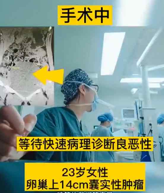 得知患者肿瘤良性医生高兴欢呼 反应太真实！网友：看得我眼泪都出来了