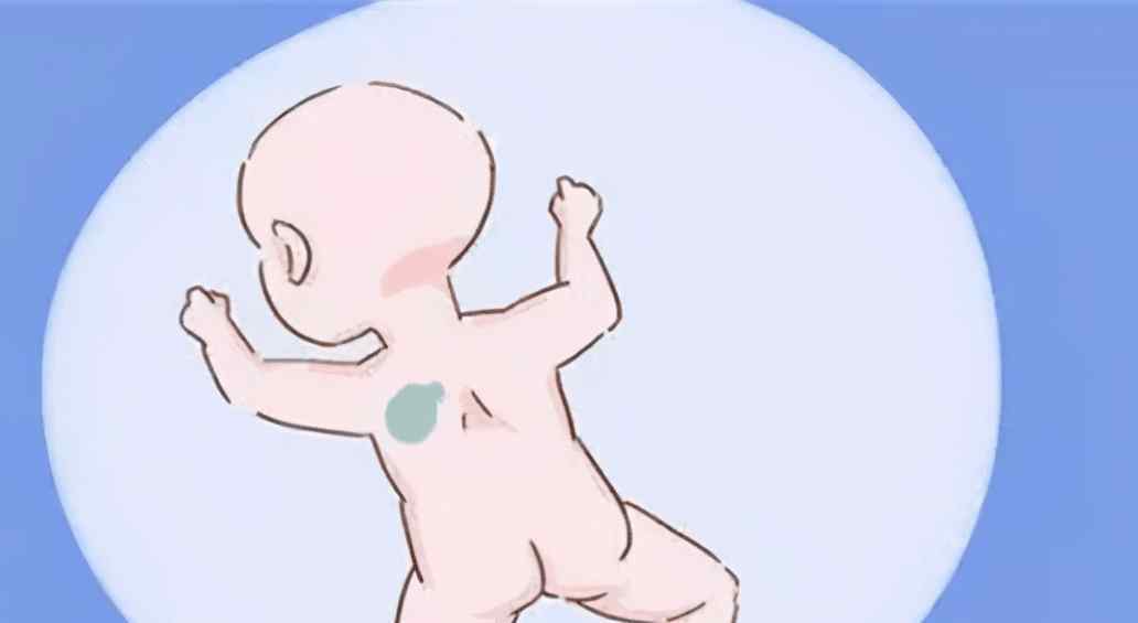 婴儿胎记的成因 宝宝出现胎记的原因是什么？该怎样预防呢？