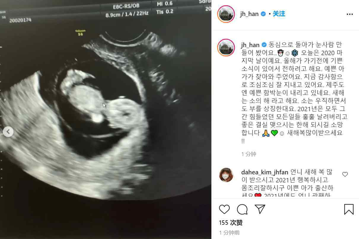 韩智慧结婚 韩智慧结婚10年官宣怀孕，前任李东健未婚先孕又离婚堪比闹剧