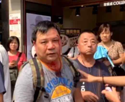 摘黑衣人头套的他说做了该做的 保护香港保护国家