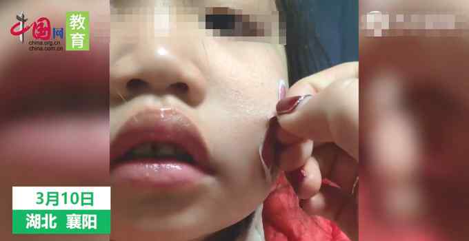 表现好被幼儿园老师贴贴纸奖励 女儿回到家妈妈却发现悲剧了！