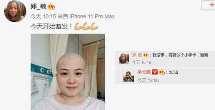 岳云鹏老婆回应生病剃光头 郑敏发生了什么