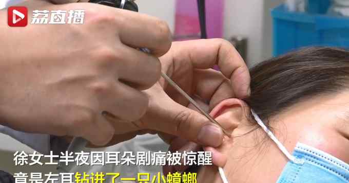 最怕的事还是发生了！孩子床上吃零食引蟑螂钻进妈妈耳朵 医生提醒