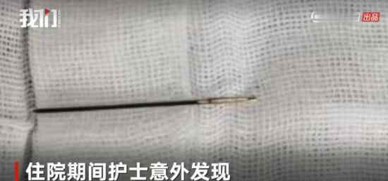 男婴被插绣花针 具体情况是什么?为什么插绣花针?