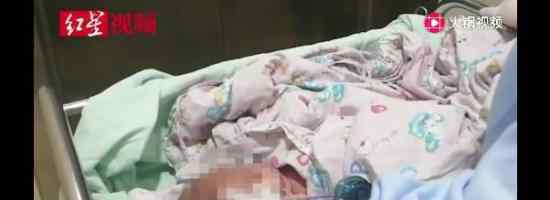 男婴被插绣花针父母皆不知情具体什么情况