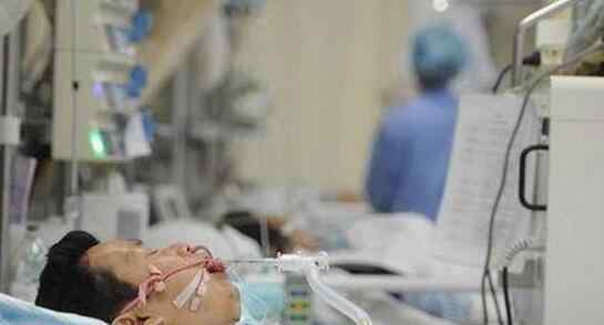 天花病图片 人类历史上最可怕的十大病毒，天花死了1.5亿人