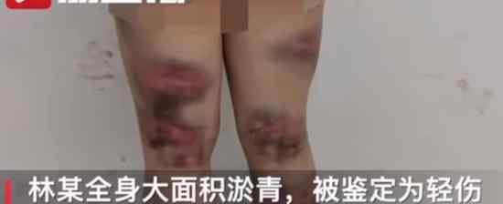 年龄大了必须要结婚吗 江苏一女子因未婚被亲妈殴打