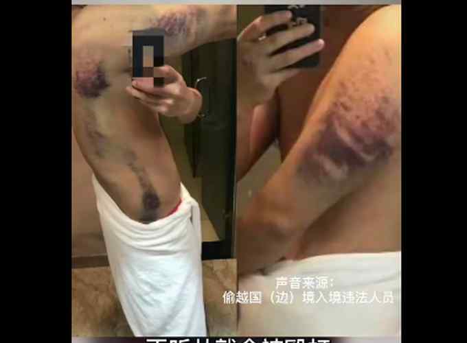 皮鞭、木棍、水牢……缅北的“发财梦” 成了噩梦