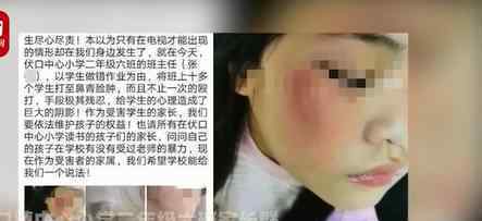 小学生因写错字被老师打伤 涉事学校怎么回应
