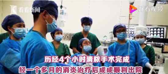 半岁宝宝鼻窦发炎险失明 孩子健康可马虎不得